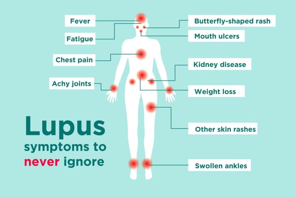Signs And Symptoms Of Lupus Lupus Association Of Nsw Inc