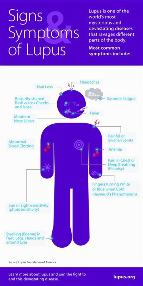 Diagnosing Lupus Lupus Association Of NSW Inc Diagnosing Lupus Lupus Association Of NSW Inc